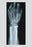 Arm and Finger Repair 28x42 Giclee on Canvas