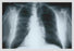 Chest 28x42 Giclee on Canvas